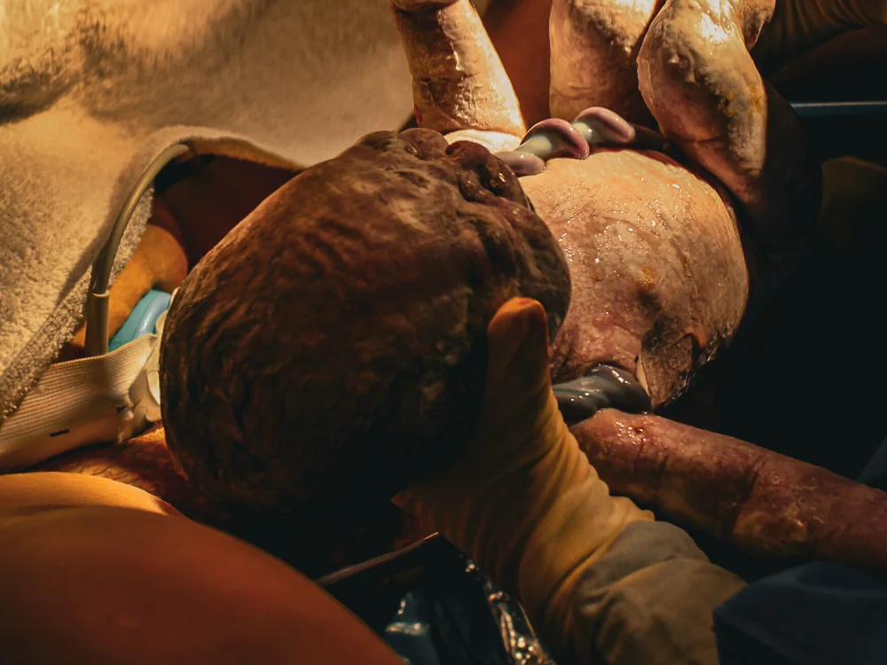 The Miracle of Birth